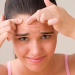 Acne-Remedies-For-Pimples